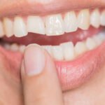 Broken Tooth