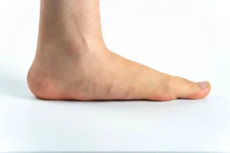 Flat Feet in Adults