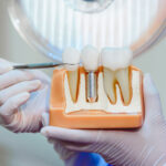 Innovations in Dental Implant