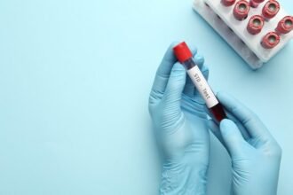 STD Screening