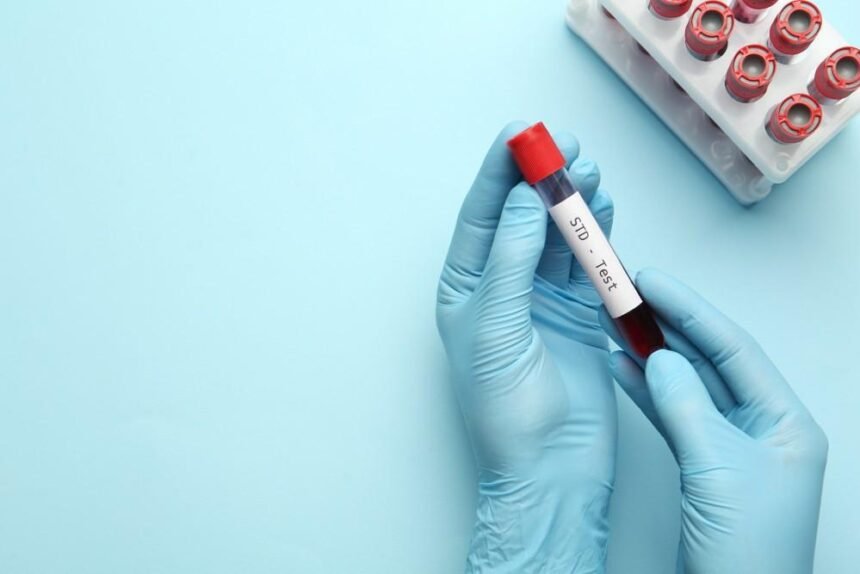 STD Screening